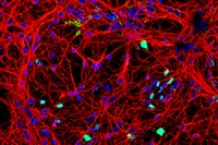 Cultius de cèl·lules neuronals vistos a través d’un microscopi confocal. 