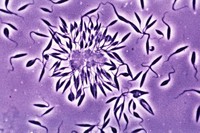 Microfotografía del Trypanosoma cruzi, el parásito que causa la enfermedad de Chagas (OMS / TDR)